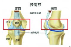 齐来认识髌骨股骨疼痛症候群